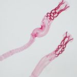 What Are Parasites, And How Do They Affect You