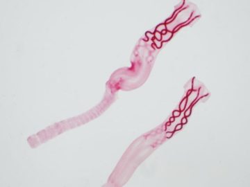 What Are Parasites, And How Do They Affect You