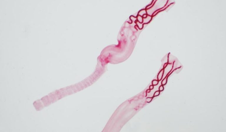 What Are Parasites, And How Do They Affect You