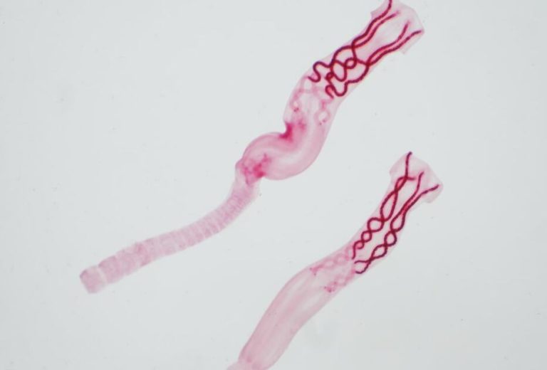 What Are Parasites, And How Do They Affect You