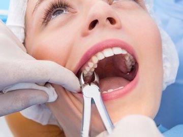 How To Sleep After Tooth Extraction