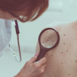 Which Are The Different Types Of Skin Cancer Specialists