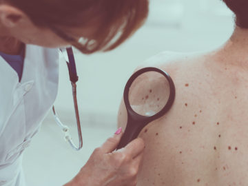 Which Are The Different Types Of Skin Cancer Specialists