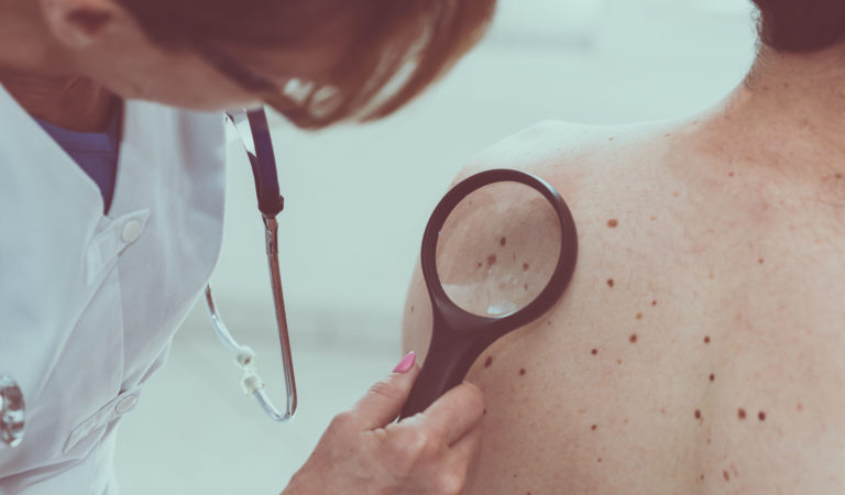 Which Are The Different Types Of Skin Cancer Specialists