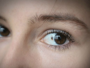 eye melanoma